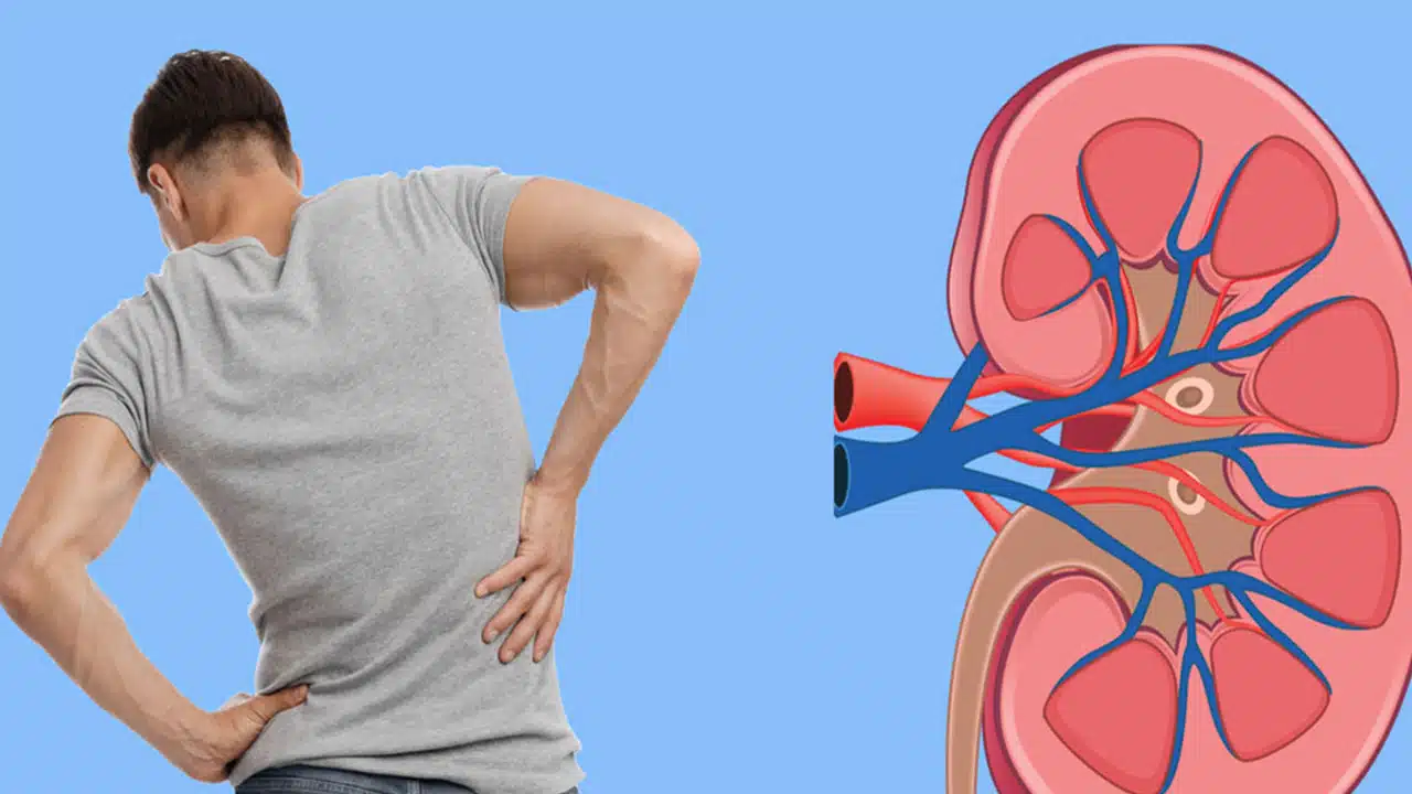 ঘরে বসেই কিডনি পরীক্ষা করার সহজ উপায়